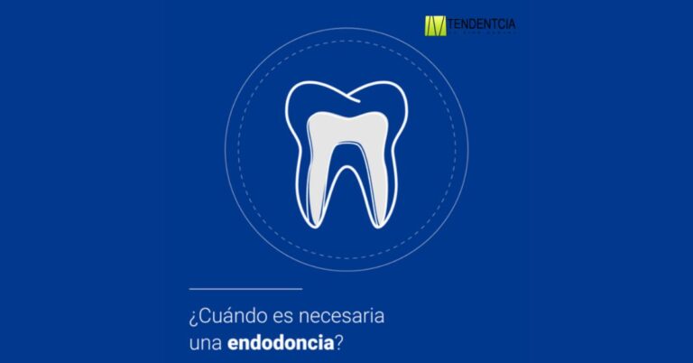 endodoncia